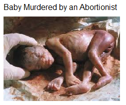 Baby 21 Aborted by abortionist