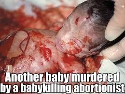 Baby Murdered by a Babykilling Abortionist