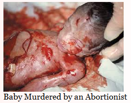 Unborn baby killed