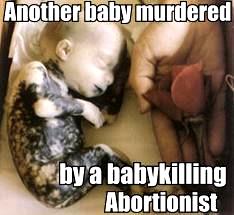 Aborted baby