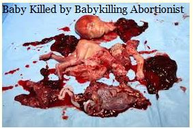 Baby killed by abortion