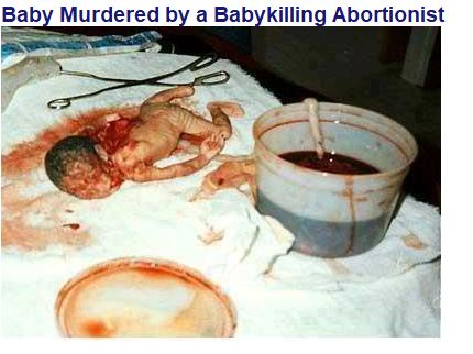 Baby murdered by abortion