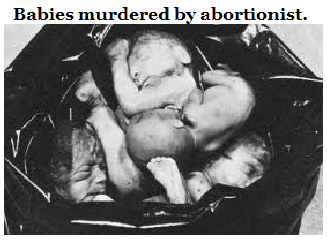 Baby died by abortion