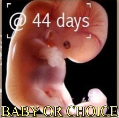 Baby or Choice