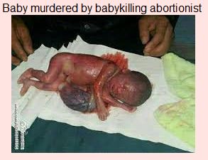 Aborted Baby Killed by Abortion