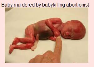 baby aborted by abortionist