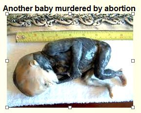Baby Murdered by Abortion